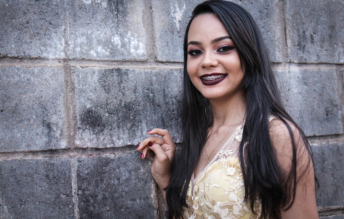 Fiksni aparatić za zube